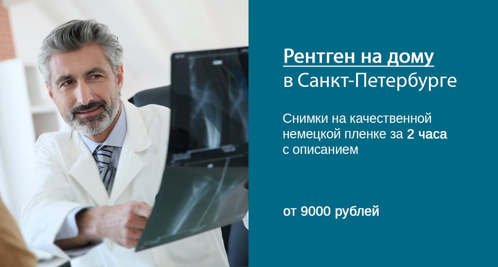 Врач-рентгенолог изучает рентгеновские снимки